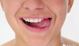 吃酥瓜舌头疼,头痛之谜待揭晓